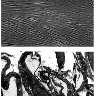 Electron Microscopic Autoradiography Of Cultured Human Broblasts Fed