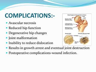 Hip dislocation | PPT