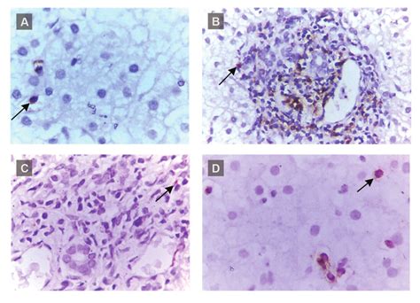 Typical Staining Of Immunohistochemistry Detection Of Cell Populations