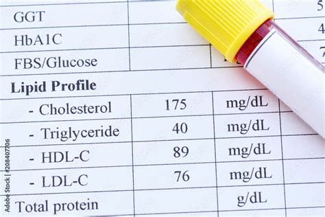 Normal Lipid Profile Test Result With Blood Sample Tube Stock Photo