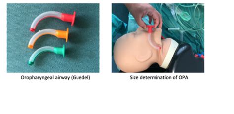 Airway Management Flashcards Quizlet