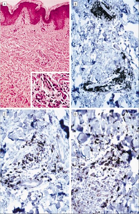 Histologic And Immunohistochemical Findings A Microscopic Examination