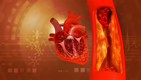 5 Vitamins That Remove Plaque From Arteries - Showit Blog