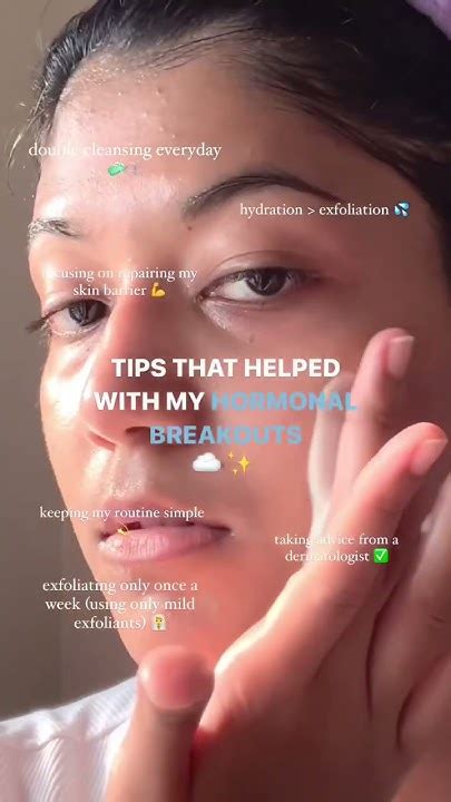 How I Healed My Hormonal Acne Skincare Skincaretips Youtube