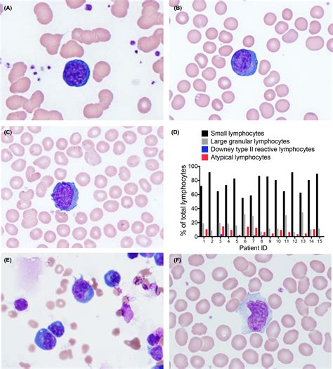 British Journal Of Haematology Wiley Online Library