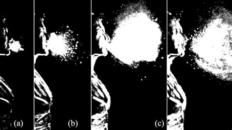 High Speed Images Freeze The Sneeze And Help Explain The Spread Of