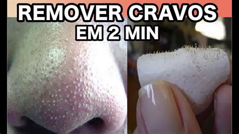 COMO REMOVER CRAVOS DO NARIZ EM 2 MINUTOS YouTube