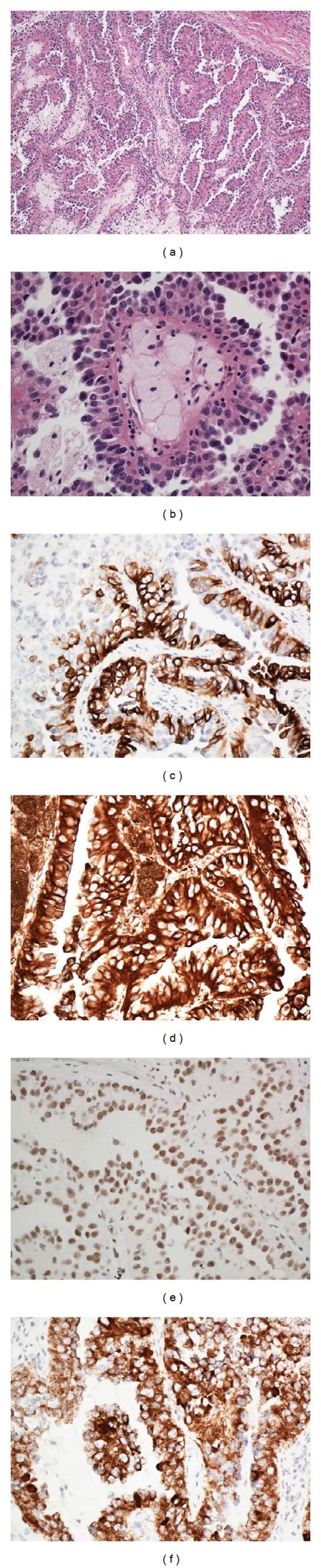 Histological And Immunohistochemical Features Of The Papillary Renal