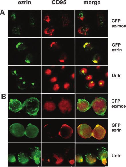 Colocalization Of Gfp Tagged Ezrin And Cd A Confocal Analysis Of