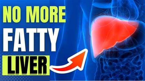 Fatty Liver Fix 20 Superfoods You Must Try Today Youtube