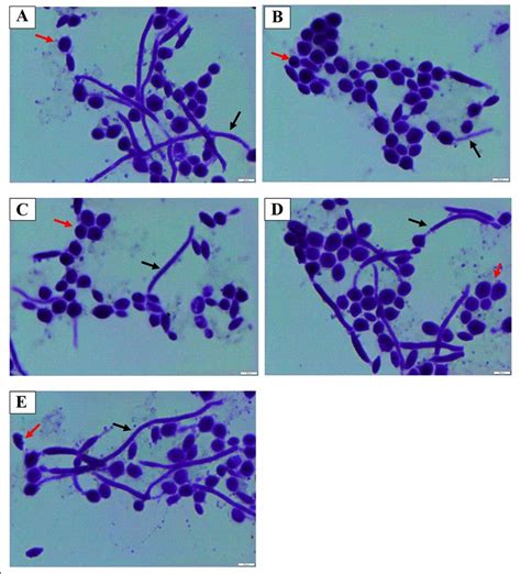 Candida Albicans Cells With Germ Tube Formation And The Effect Of Download Scientific Diagram