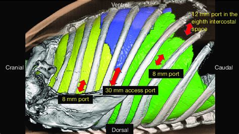 Port Arrangement In The Hamamatsu Method Kai Four Robotic Arms Are