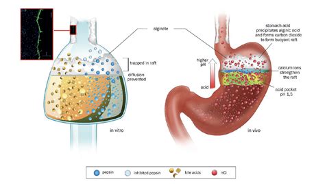 Alginates From The Ocean To Gastroesophageal Reflux Disease Treatment