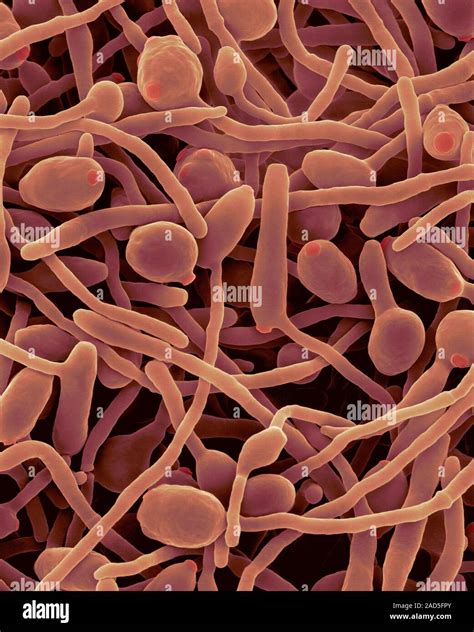 Coloured Scanning Electron Micrograph Sem Of Candida Albicans Yeast