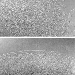 Light Microscopy Of Zones Of Twitching Motility A And B Show