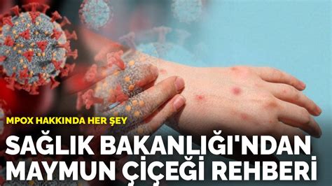 Sağlık Bakanlığı ndan maymun çiçeği rehberi