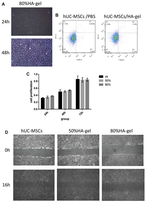 Human Umbilical Cord Derived Mesenchymal Stem Cells And Auto