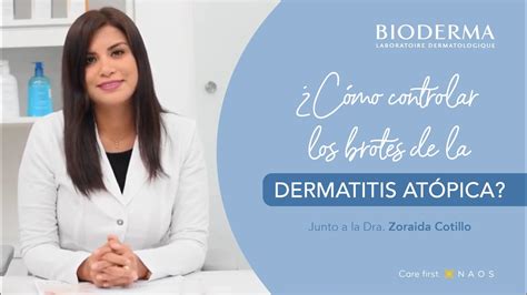 Cómo controlar los brotes de la dermatitis atópica Testimonio YouTube