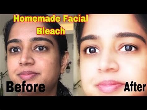 Skin Whitening Homemade Facial Bleach Bleach Skin At Home Naturally