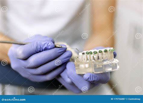 The Dentist Shows An Artificial Model Of The Jaw With Braces How To