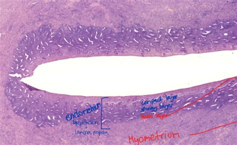 Topic 49 50 54 Uterus Proliferative And Secretory Phase Pregnant