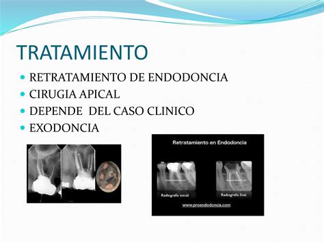 Diagnostico Pulpar Y Periapical Endo Pptx