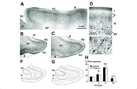 Distribution Of Parvalbumin Pv Ir Neurons In The Piriform Network Download Scientific