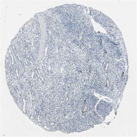 Tissue Expression Of Ldlr Staining In Ovary The Human Protein Atlas