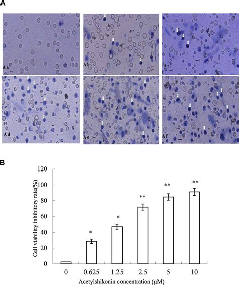 The Effects Of Acetylshikoninon On The Viability Of K562 Cells A