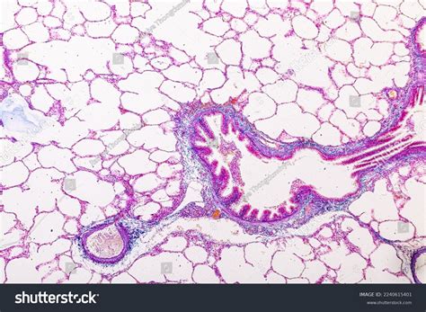 Lung Pituitary Gland Human Under Microscope Stock Photo 2240615401