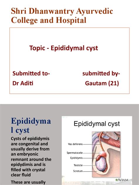 An In Depth Look At Epididymal Cysts Causes Symptoms Diagnosis And Treatment Options Pdf