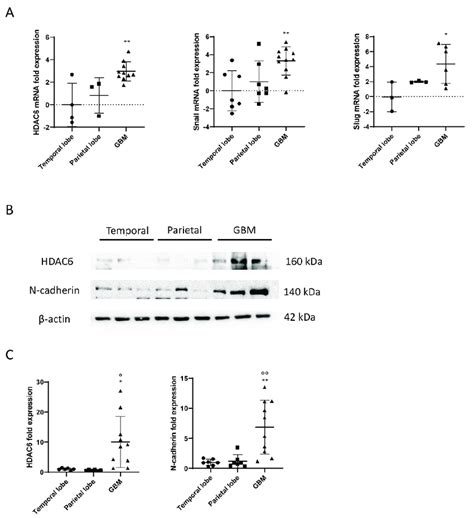 Mrna And Protein Overexpression Of Hdac And Mesenchymal Markers In Gbm