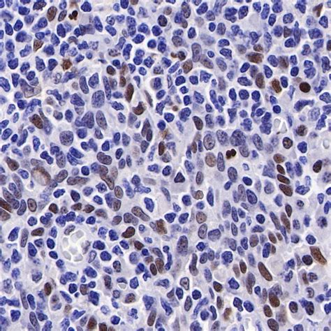 PMS2 Recombinant Rabbit MAb SDT 111 307 P54278 Starter Bio