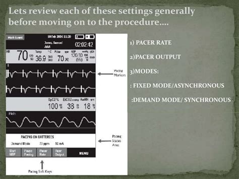 Transcutaneous pacing