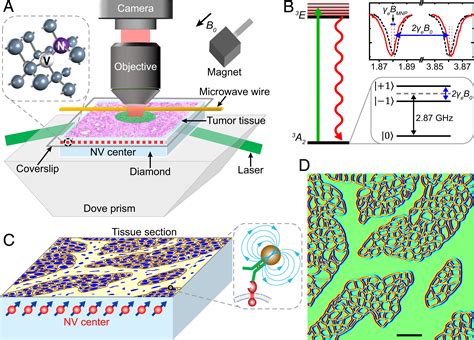 Immunomagnetic Microscopy Of Tumor Tissues Using Quantum Sensors In