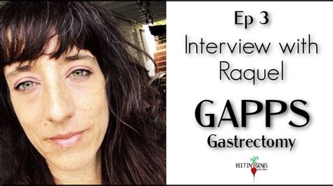 Ep 3 Raquel Gapps Genetic Mutation Gastrectomy Youtube