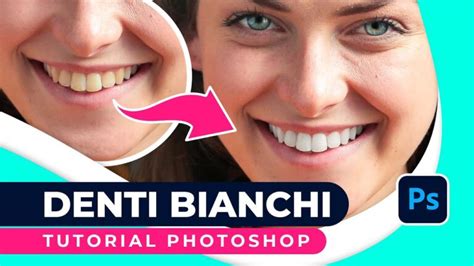 App Per Sbiancare I Denti La Guida Completa Actualizado Gennaio