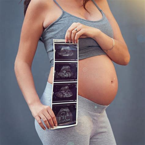 Babys First Picture A Pregnant Woman Holding Her Sonogram Picture