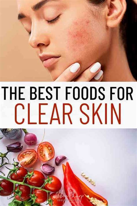 The Hormonal Acne Diet The Best Foods For Healthy Clear Skin Acne Diet Hormonal Acne Diet