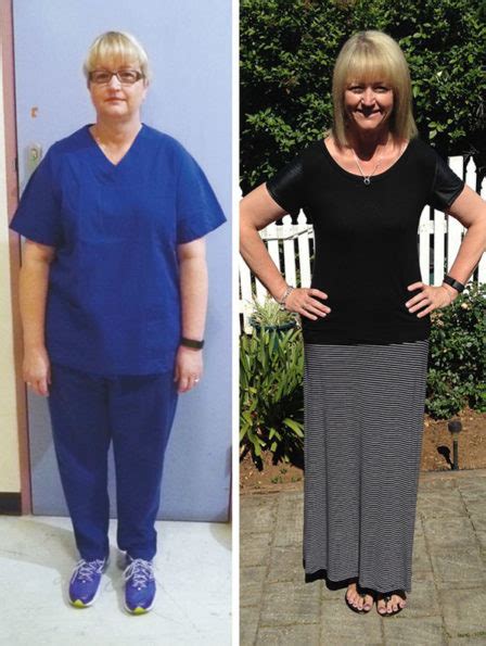 Weight Loss Success Louise J Prospect Healthy Inspirations