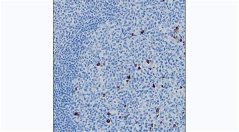 Human Igg3 Monoclonal Antibody 8d9 Invitrogen 100 μg Unconjugated