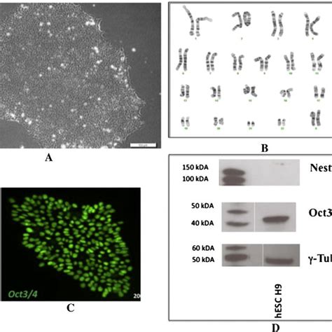 Expression Of Pluripotency Markers And Karyotyping Of Hesc Cell Line