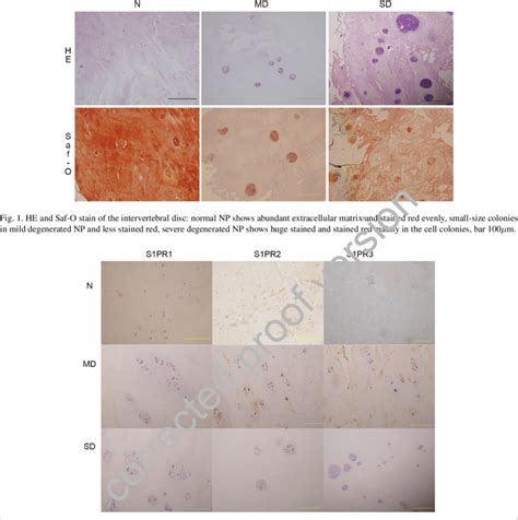The expression of S1PR in NP was shown by immunohistochemistry. S1PR1 ... 