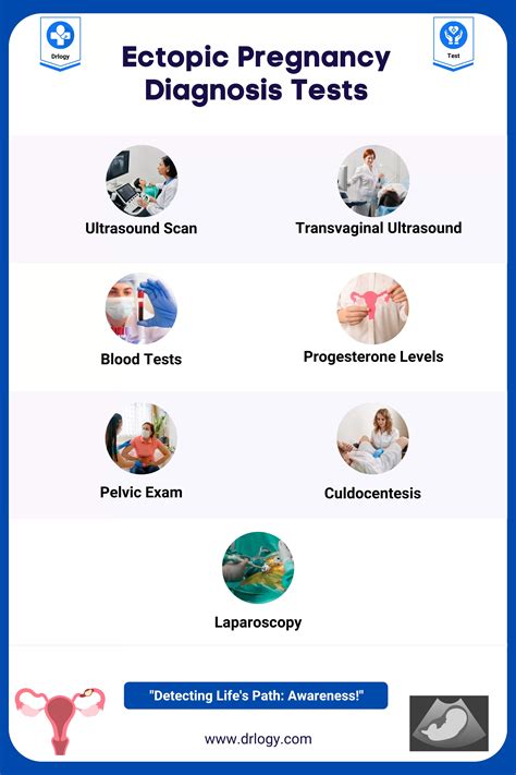 7 Reliable Tests For Ectopic Pregnancy Diagnosis Drlogy