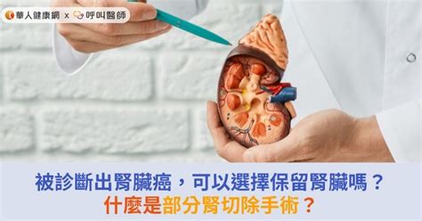 被診斷出腎臟癌，可以選擇保留腎臟嗎？什麼是部分腎切除手術？ 華人健康網 專業即時優質的健康新聞及資訊分享平台業即時優質的健康新聞及資訊分享平台