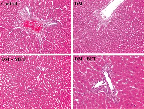 Betaine Treatment Decreased Serum Glucose And Lipid Levels Hepatic And