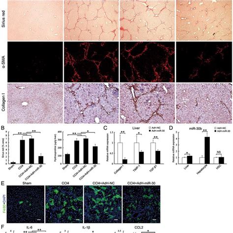 Knockdown Of Lincrna P In Hepatocyte Suppresses Ccl Induced Liver