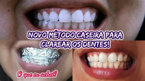 COMO CLAREAR OS DENTES EM CASA DE MANEIRA INUSITADA RECEITA CASEIRA