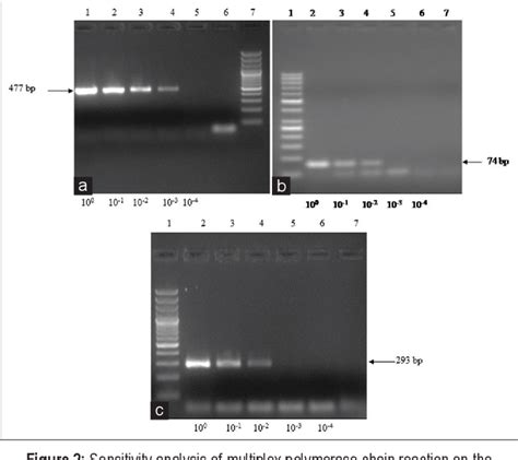 Figure From Multiplex Pcr Assay For Simultaneous Detection And