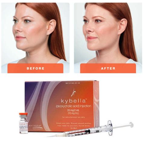 Belkyra Or Kybella Double Chin Injectable F Xbc Lipolytic Solution